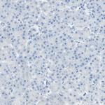 CDHR5 Antibody in Immunohistochemistry (Paraffin) (IHC (P))