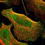 CD79b Polyclonal Antibody