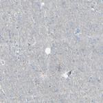 CD79b Antibody in Immunohistochemistry (Paraffin) (IHC (P))