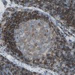 CD79b Antibody in Immunohistochemistry (Paraffin) (IHC (P))