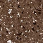 MAPRE3 Polyclonal Antibody