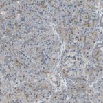 B7-H3 Antibody in Immunohistochemistry (Paraffin) (IHC (P))
