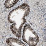 B7-H3 Antibody in Immunohistochemistry (Paraffin) (IHC (P))