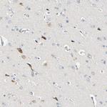 LDLR Antibody in Immunohistochemistry (Paraffin) (IHC (P))