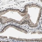 ZNF174 Antibody in Immunohistochemistry (Paraffin) (IHC (P))