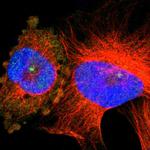 SERPINB6 Polyclonal Antibody