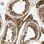 SERPINB6 Antibody in Immunohistochemistry (Paraffin) (IHC (P))