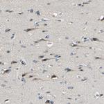 PIP5K1B Antibody in Immunohistochemistry (Paraffin) (IHC (P))