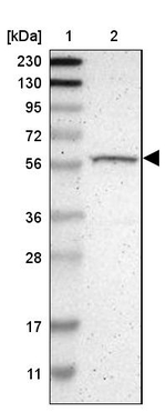 RPS6KB2 Antibody in Western Blot (WB)