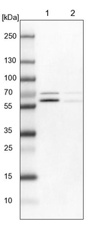 RPS6KB2 Antibody in Western Blot (WB)