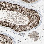 HSPA4 Antibody in Immunohistochemistry (Paraffin) (IHC (P))