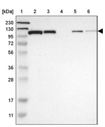 HSPA4 Antibody in Western Blot (WB)