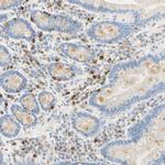 CD63 Antibody in Immunohistochemistry (Paraffin) (IHC (P))