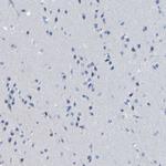 ACMSD Antibody in Immunohistochemistry (Paraffin) (IHC (P))