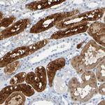 ACMSD Polyclonal Antibody