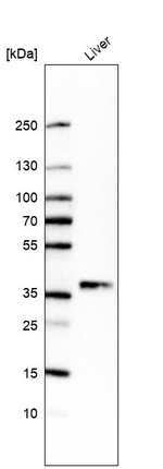 ACMSD Antibody in Western Blot (WB)