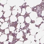 Chitotriosidase Antibody in Immunohistochemistry (Paraffin) (IHC (P))