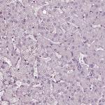 Chitotriosidase Antibody in Immunohistochemistry (Paraffin) (IHC (P))