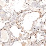 Chitotriosidase Antibody in Immunohistochemistry (Paraffin) (IHC (P))