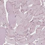 Chitotriosidase Antibody in Immunohistochemistry (Paraffin) (IHC (P))
