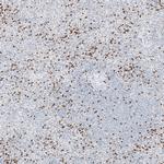 Chitotriosidase Antibody in Immunohistochemistry (Paraffin) (IHC (P))