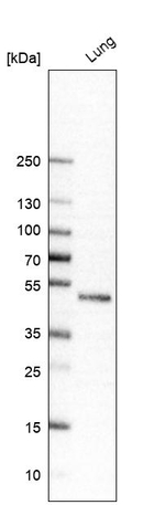 Chitotriosidase Antibody in Western Blot (WB)