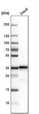 CD74 Antibody in Western Blot (WB)