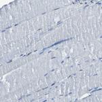 GOLPH2 Antibody in Immunohistochemistry (Paraffin) (IHC (P))