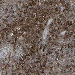 SAMSN1 Antibody in Immunohistochemistry (Paraffin) (IHC (P))