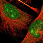 TAOK2 Polyclonal Antibody