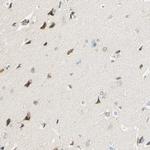 TAOK2 Antibody in Immunohistochemistry (Paraffin) (IHC (P))