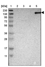 TAOK2 Antibody in Western Blot (WB)