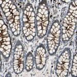 LMTK2 Antibody in Immunohistochemistry (Paraffin) (IHC (P))