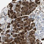 NCBP2L Polyclonal Antibody