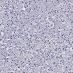 CD1a Antibody in Immunohistochemistry (Paraffin) (IHC (P))