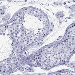 CD1a Polyclonal Antibody