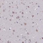 FAM234B Antibody in Immunohistochemistry (Paraffin) (IHC (P))