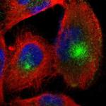 Nectin 3 Polyclonal Antibody