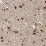 Nectin 3 Antibody in Immunohistochemistry (Paraffin) (IHC (P))
