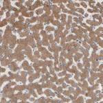 Nectin 3 Antibody in Immunohistochemistry (Paraffin) (IHC (P))