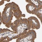 Nectin 3 Antibody in Immunohistochemistry (Paraffin) (IHC (P))
