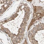 Nectin 3 Antibody in Immunohistochemistry (Paraffin) (IHC (P))