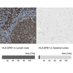 HLA-DPB1 Antibody