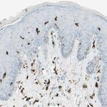 HLA-DPB1 Antibody in Immunohistochemistry (Paraffin) (IHC (P))