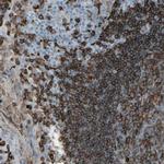 HLA-DPB1 Antibody in Immunohistochemistry (Paraffin) (IHC (P))