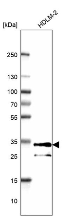 HLA-DPB1 Antibody in Western Blot (WB)