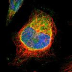 STIM1 Polyclonal Antibody