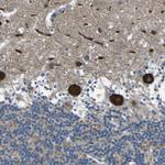 STIM1 Antibody in Immunohistochemistry (Paraffin) (IHC (P))