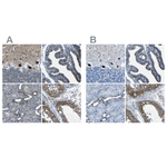 STIM1 Antibody in Immunohistochemistry (Paraffin) (IHC (P))