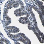 STIM1 Antibody in Immunohistochemistry (Paraffin) (IHC (P))